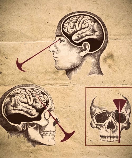 Manicomio di Volterra - Manicomio di Volterra Lobotomia %C2%A9gemma salvadori2 a40c4c37 - manicomio di volterra